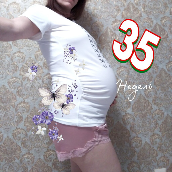🎉35 недель 🎉