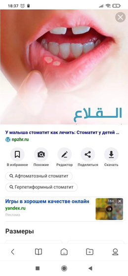 У ребенка на языке
