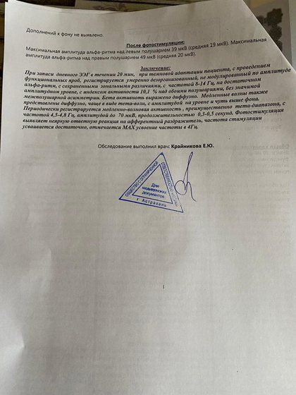 ЭЭГ головы