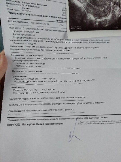 Девочки, подскажите, пожалуйста.