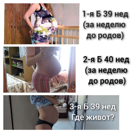 Где мой живот?