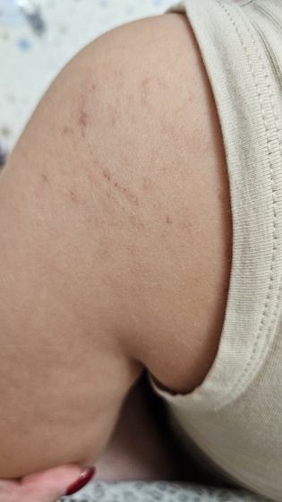 Подскажите,что это может быть? Уже дурные мысли в голову лезут 😥