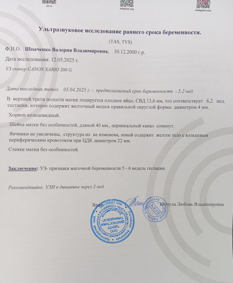 УЗИ (5 недель 2 дня)