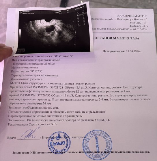 Я в шоке мягко говоря ( узи ) ?