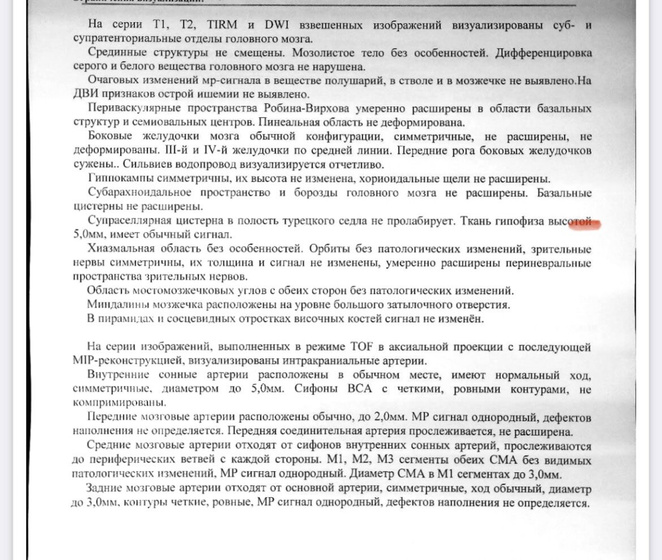 МРТ головного мозга