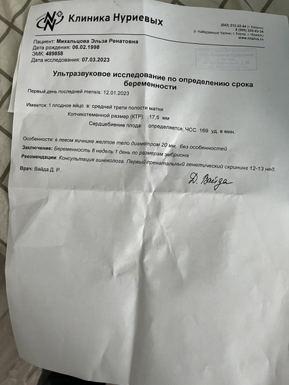 Узи