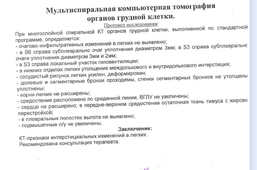 Кт лёгких
