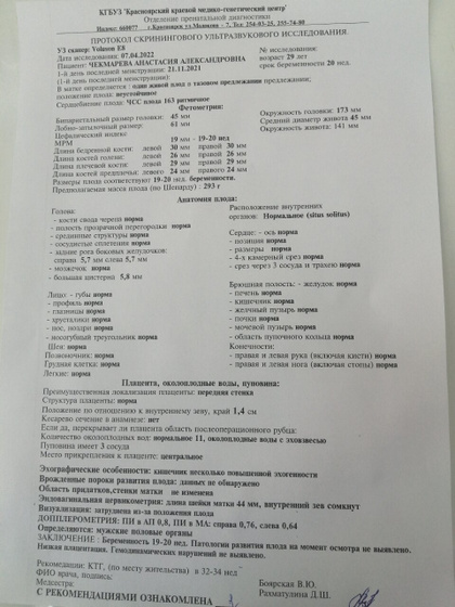Узи