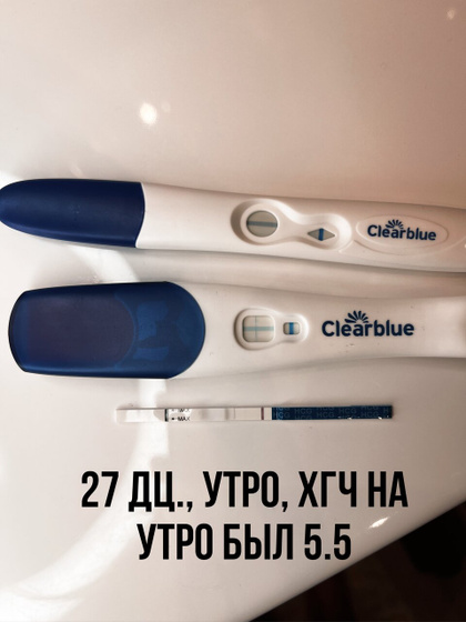 Признаки беременности до теста, сны, знаки) ??
