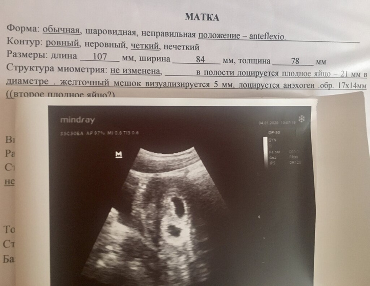 Двойняшки???!!!!!😍