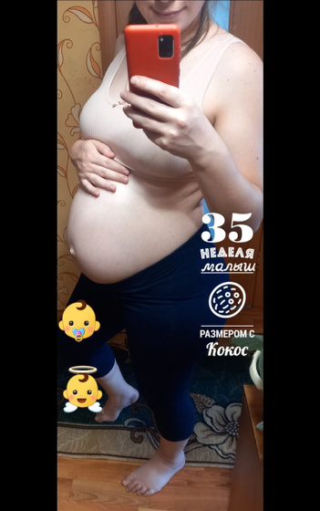 35 неделек уже ??