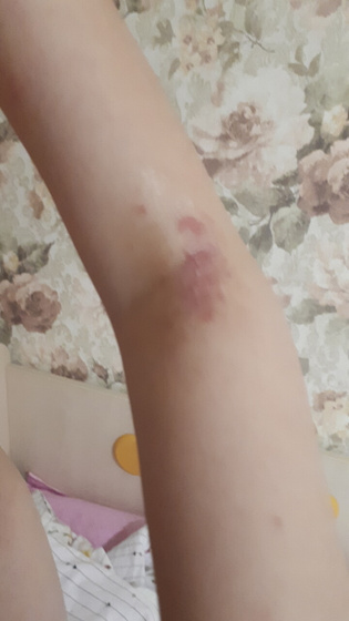 Атопический или что ,врач ошибается??😔😥