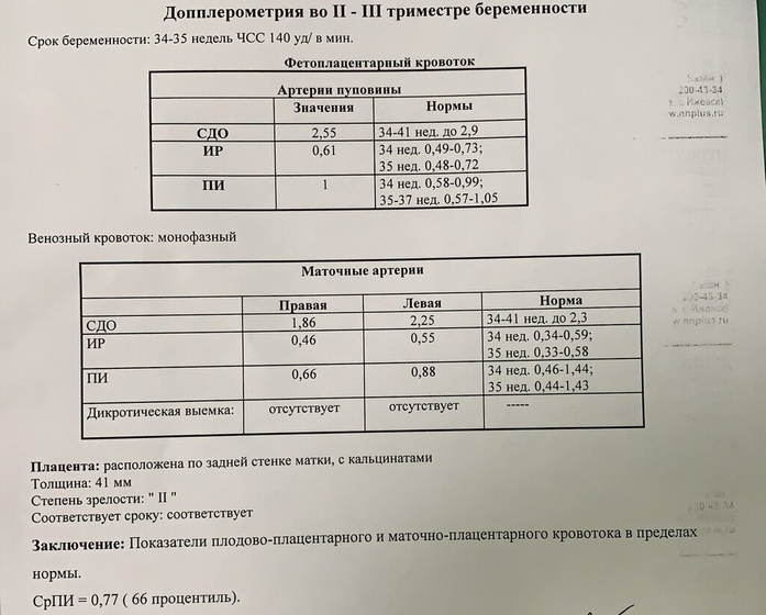 34 недели 2 дня. КТГ, допплер