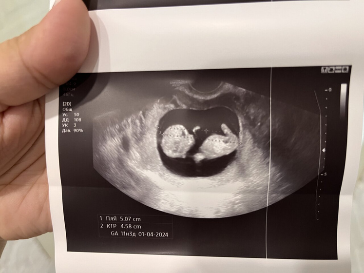 11 недель💞