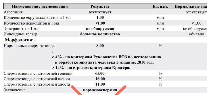 Спермограмма (для эко)