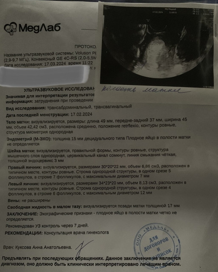 К посту об узи