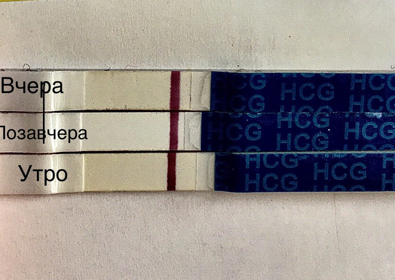 Девочки это же не полоска?