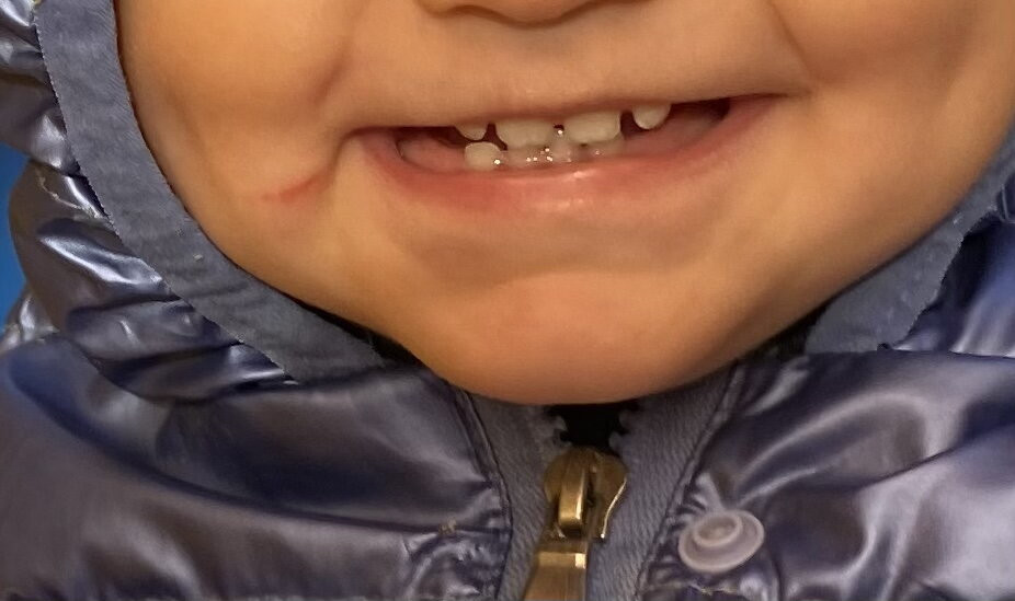 Зубы