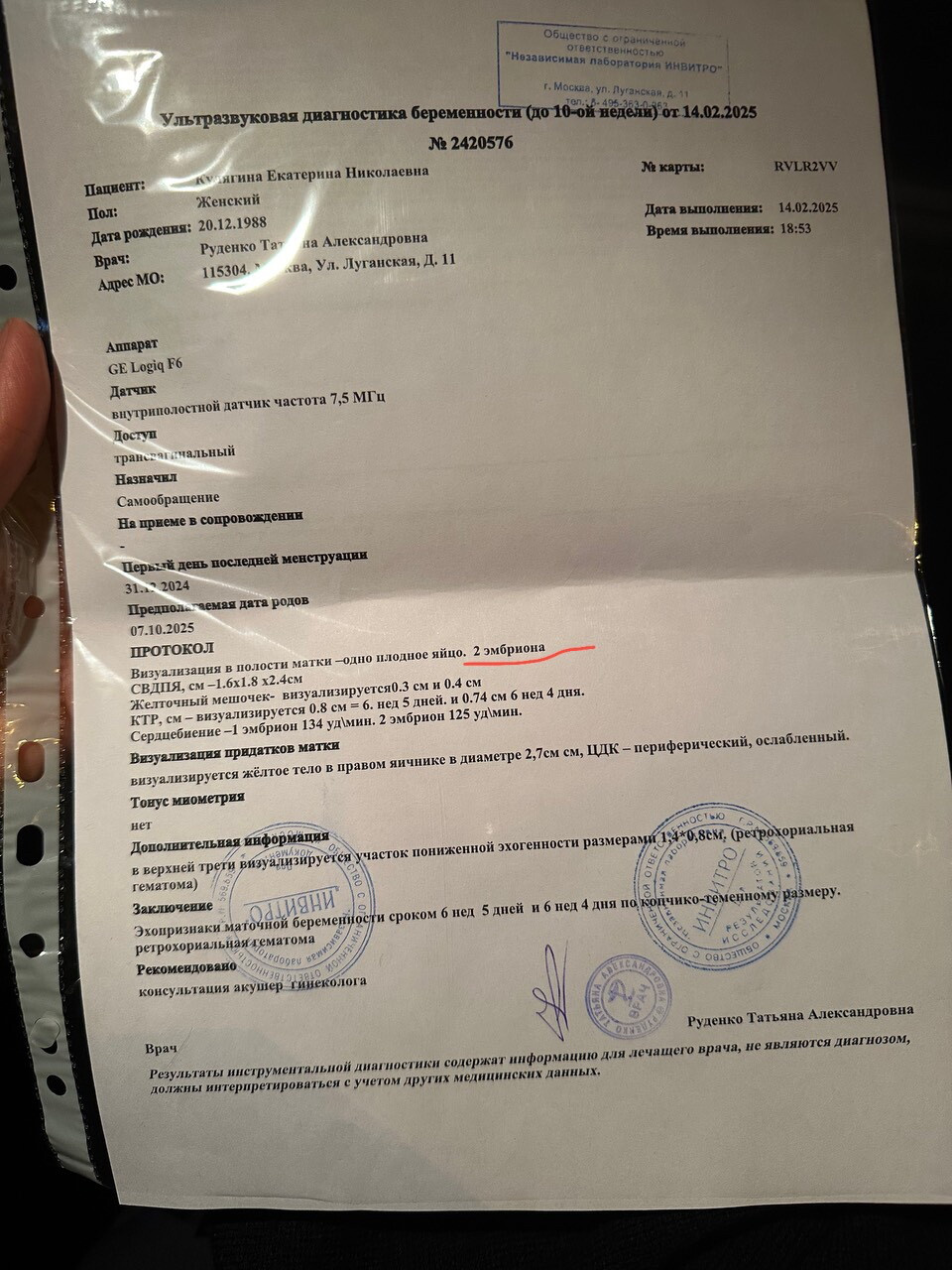 Сходила на УЗИ
