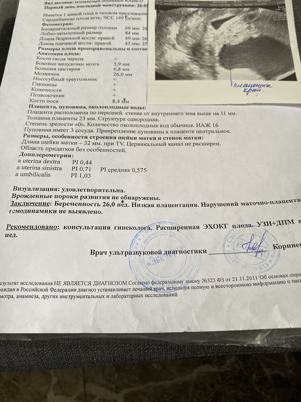 Низкая плацента 26 недель