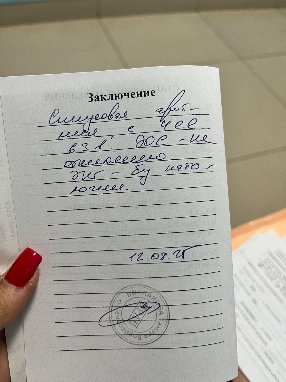 Экг