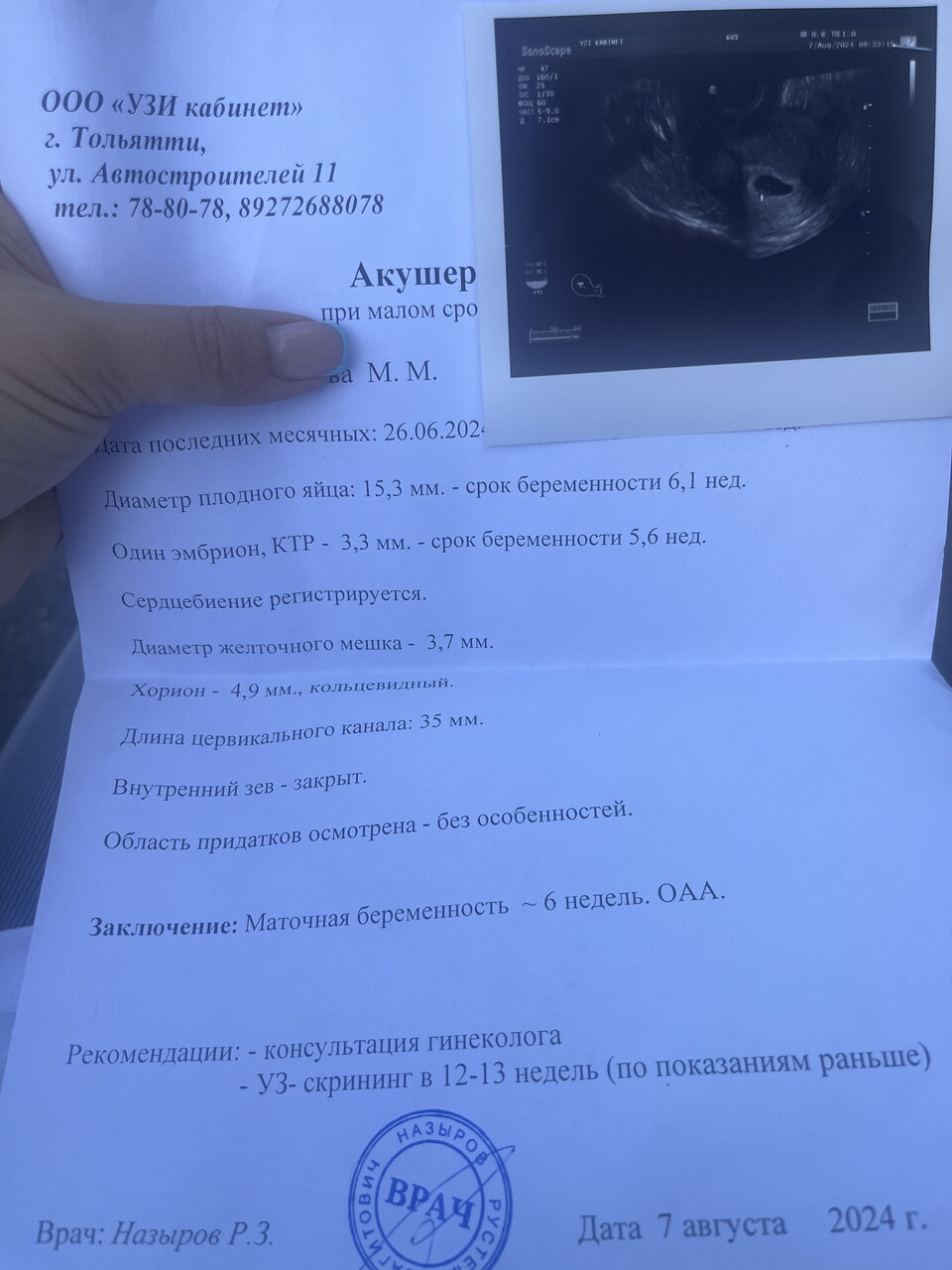 Первое Узи