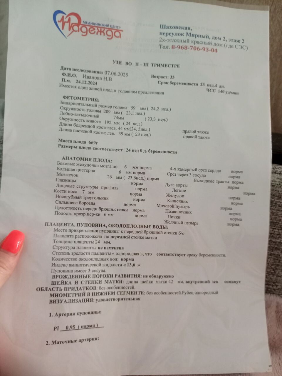 Я в восторге !