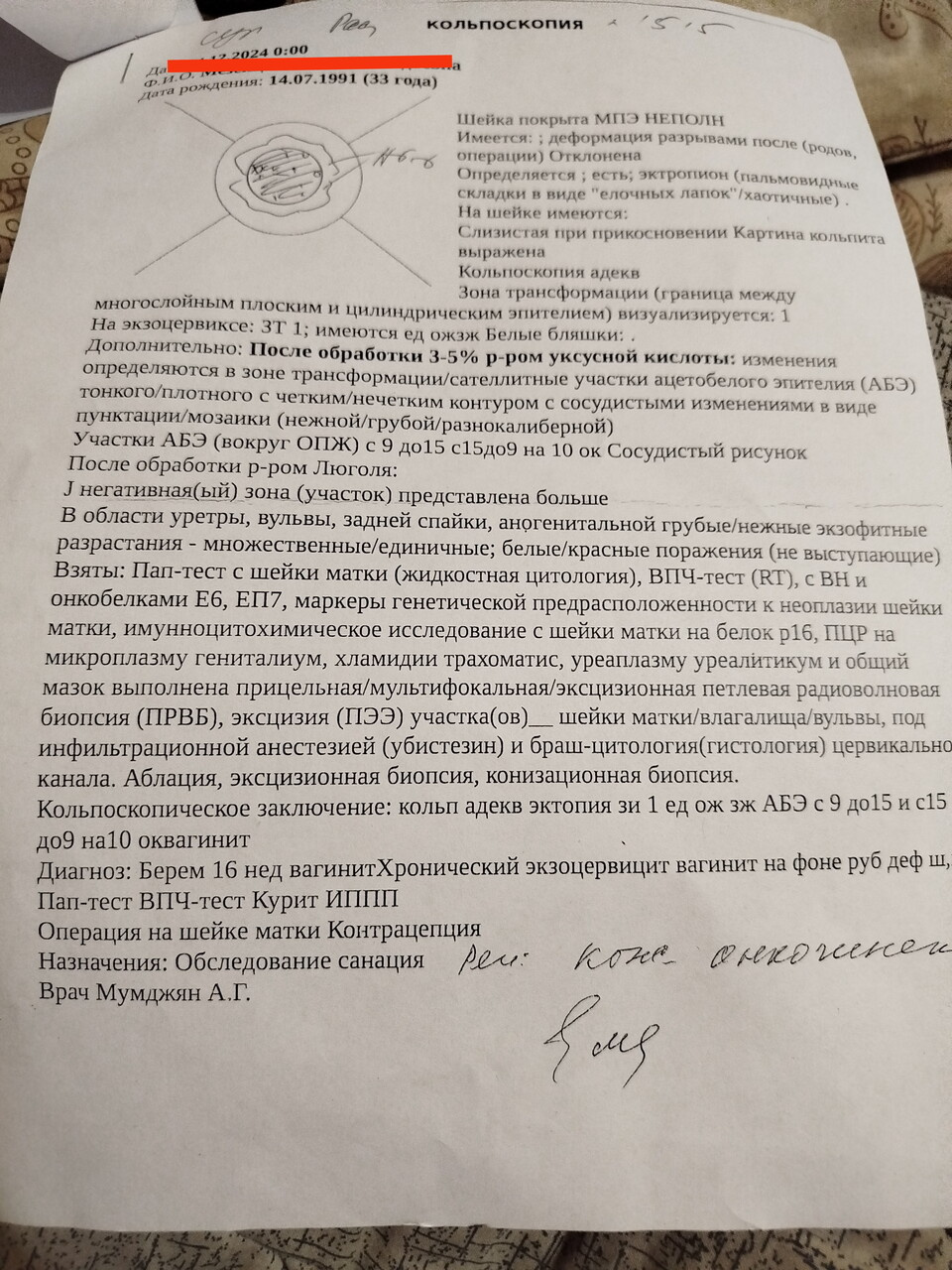 Кольпоскопия,кто сталкивался?